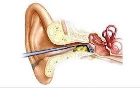 clogged ear what to do for clogged ear