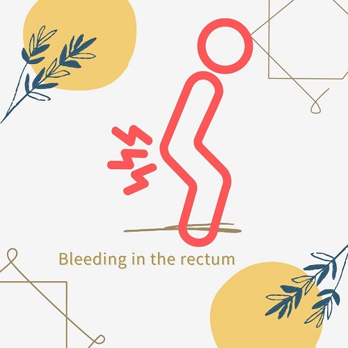 Anal Bleeding And Treatment 