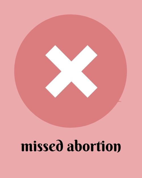 miscarriage