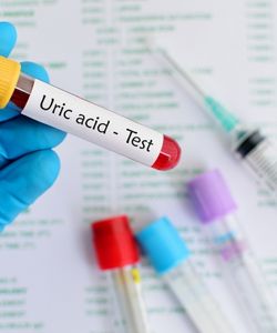 Uric Acid 
