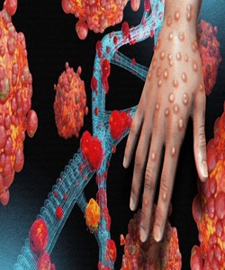 About Pox