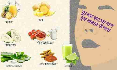 মুখের কালো দাগ  সমাধান 